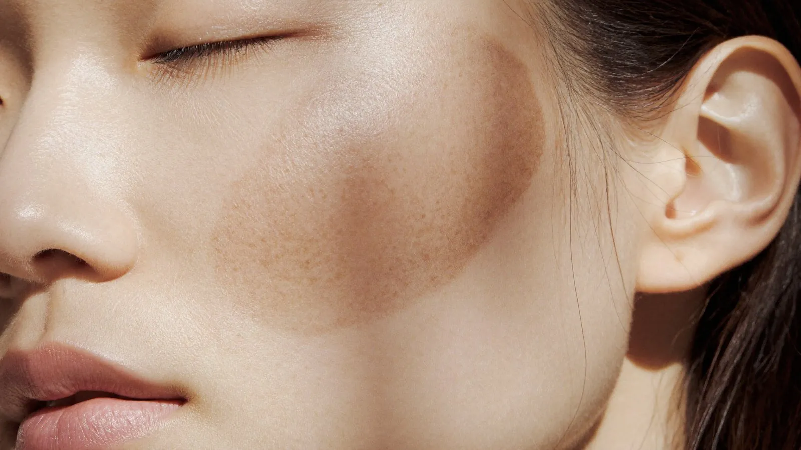 Dr Sin Yong examining facial pigmentation under clinical lighting in Singapore