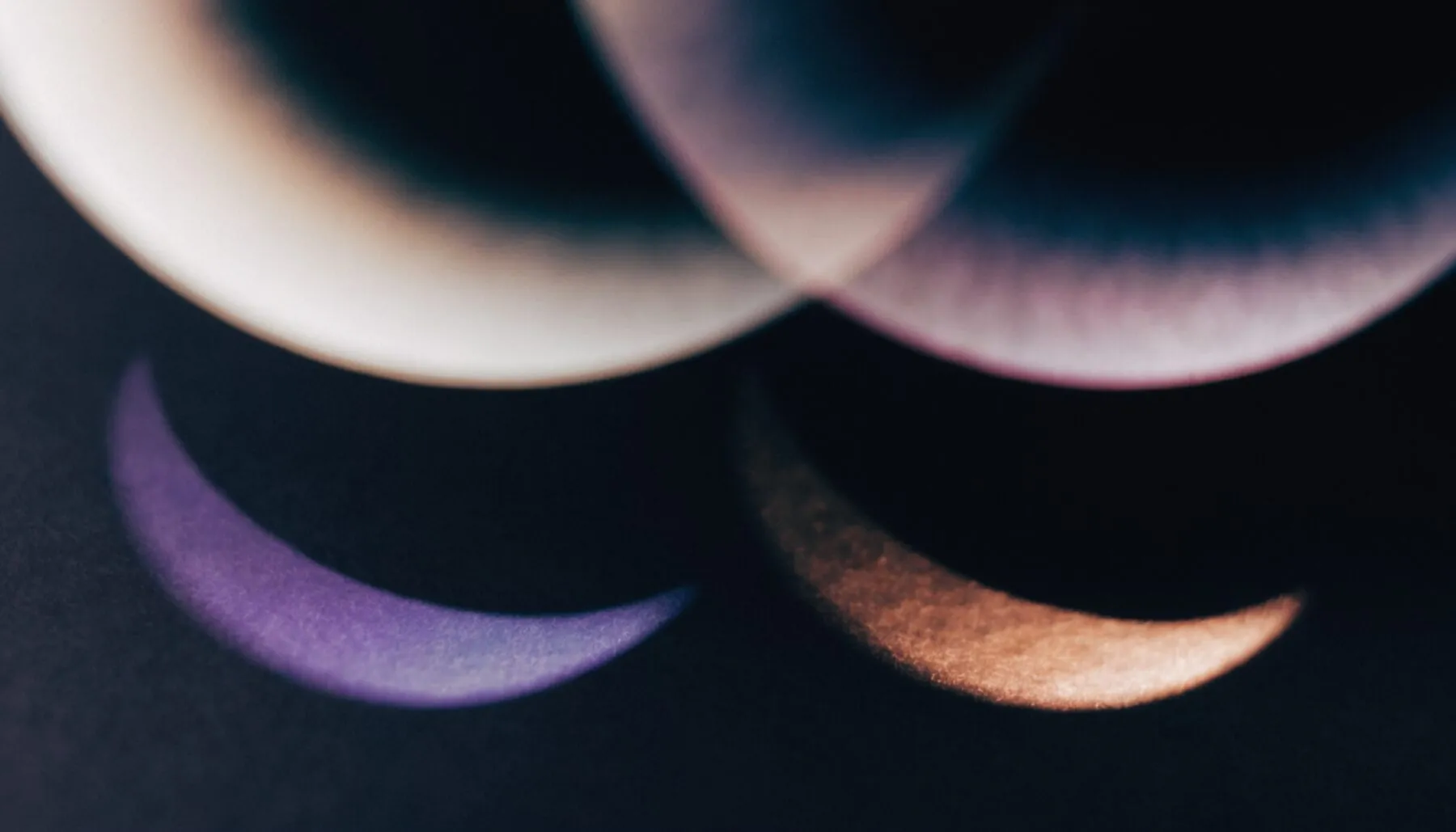 Dark Eye Circles: Which Type Is Yours? &mdash; condition guide by Dr Sin Yong